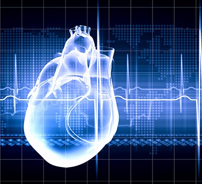 Acute Coronary Syndrome - A Pipeline Analysis Report